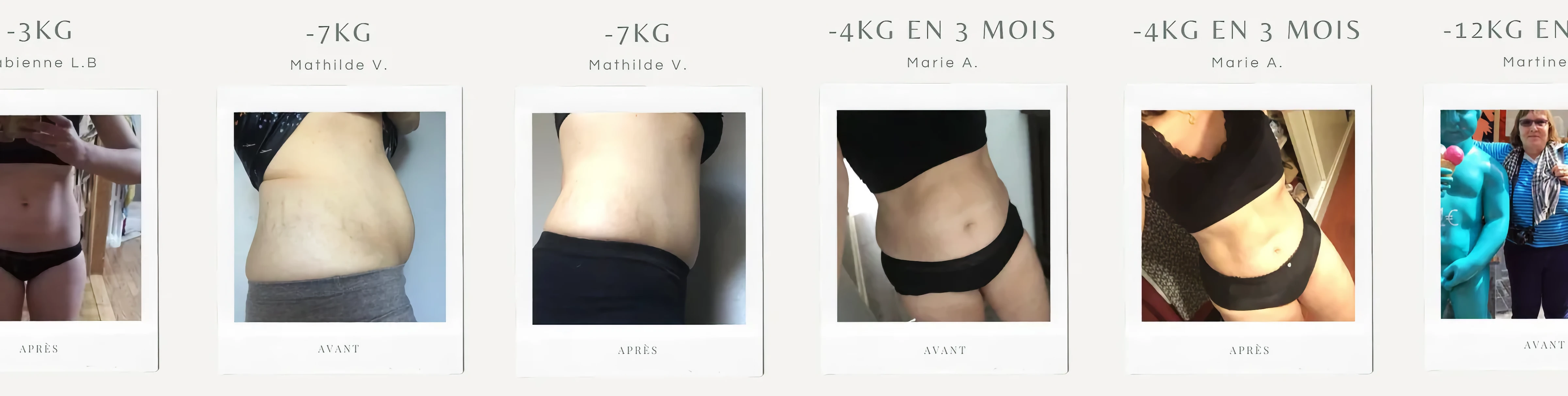 Photos avant et après — 7
