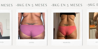 Fotos antes y después — 2