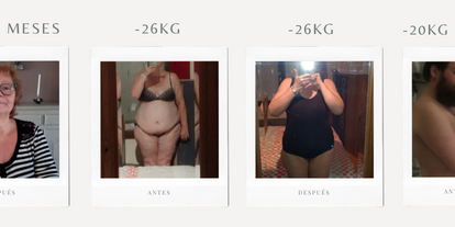 Fotos antes y después — 5